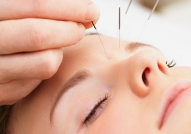 Les bases de l’acupuncture