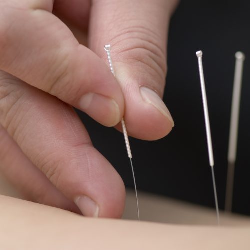 L’acupuncture et la grossesse
