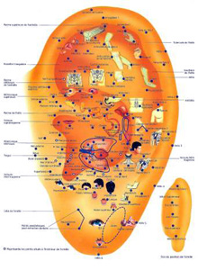 auriculotherapie