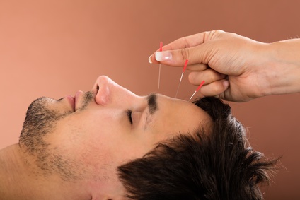 Close-up Of A Man Receiving Acupuncture Treatment In Beauty Spa