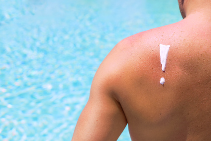 7 astuces naturelles pour calmer un coup de soleil